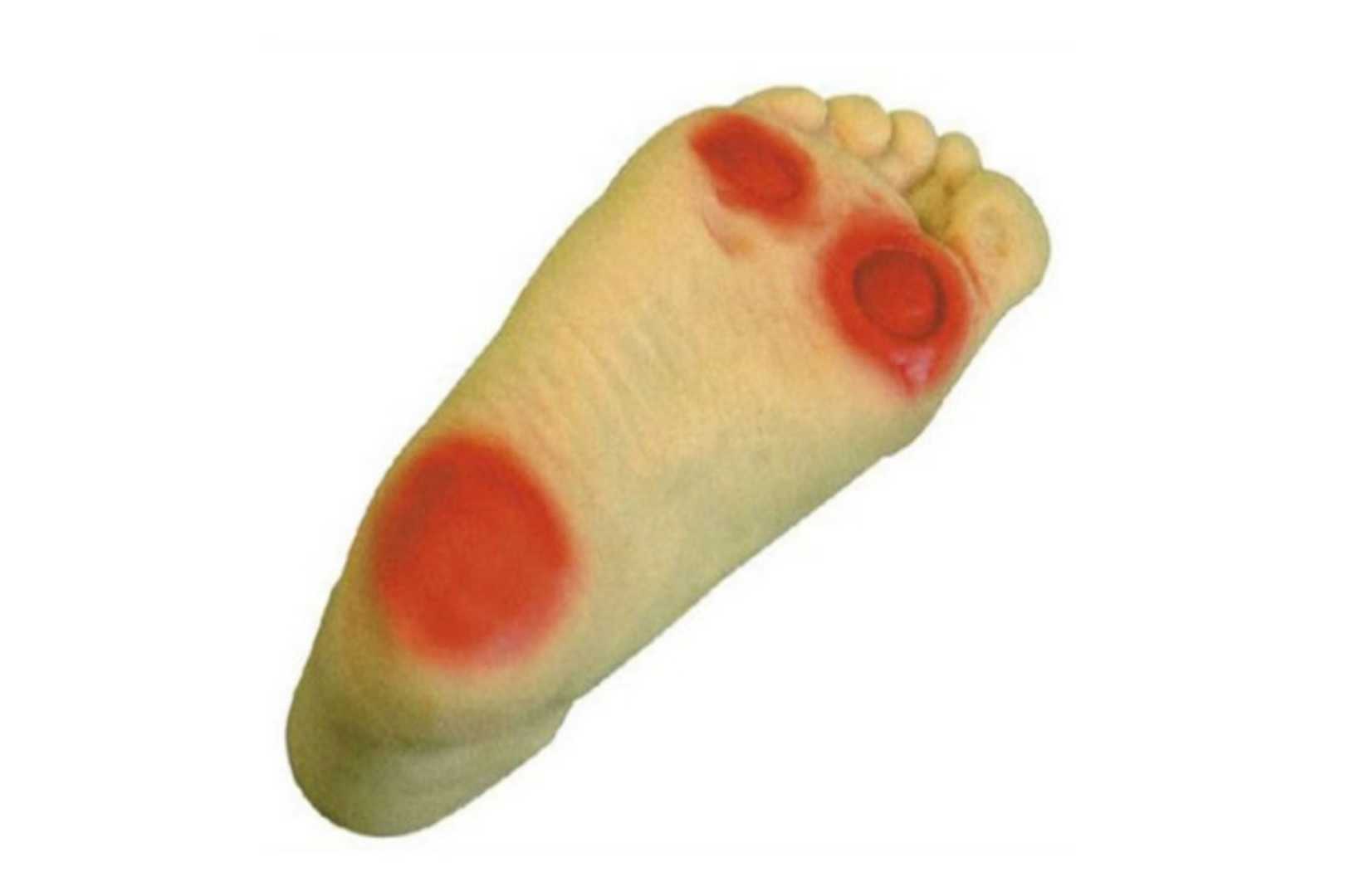 Advanced Diabetic Foot Care Model